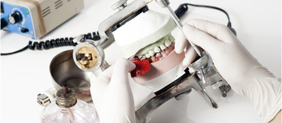 Perno a vite per protesi odontoiatrica - Teetanium ® - Medibrex Perno a vite per protesi odontoiatrica - Teetanium ® - Medibrex
